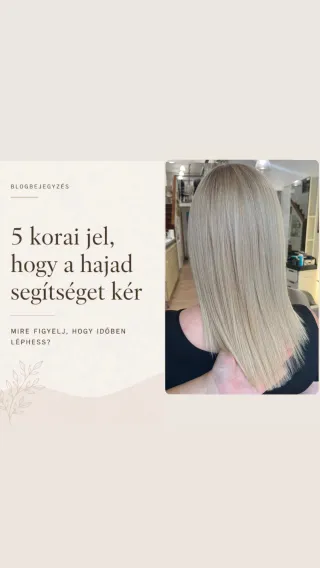  A hajhullás első jelei , amit sokan túl későn vesznek észre . galéria kép 1 